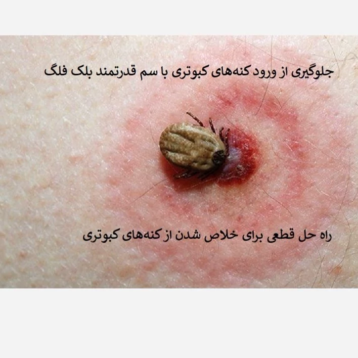 نابودی فوری کنه کبوتری با سم بلک فلگ