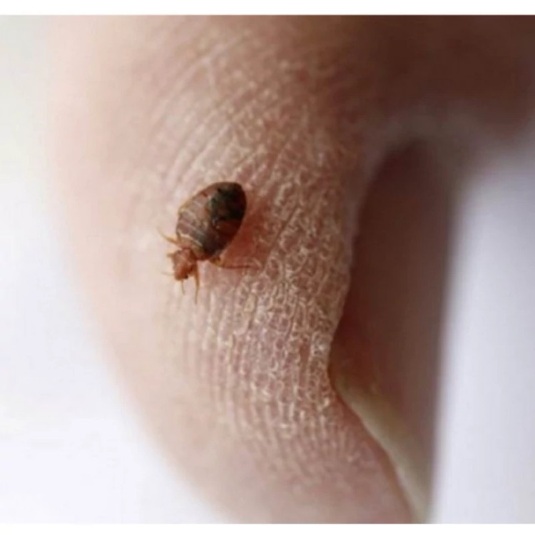 سم کشنده ساس پرومکس PROMAX هیولای مبارز ساس ها ارسال رایگان