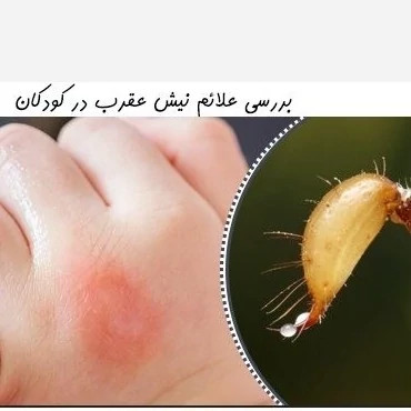 سم عقرب کش پایروساید یک لیتری بدون بو ارسال رایگان
