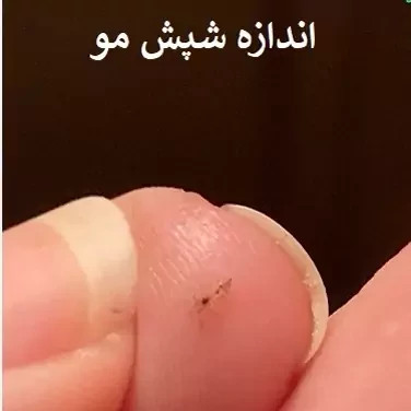 سم شپش کش پرمکترین ارسال رایگان مدل 1