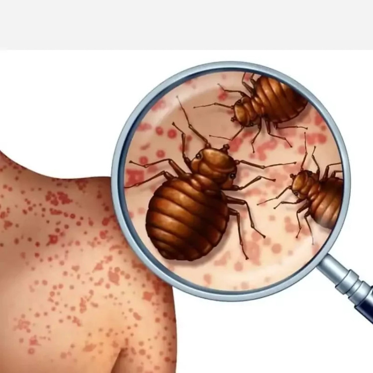 سم ساس پرو مکث رقیب ساس های خونخوار ارسال رایگان مدل 1