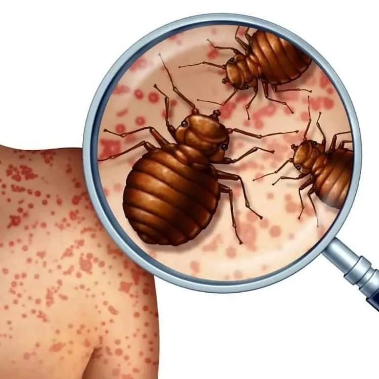 سم ساس پیرانا اصلی بایر با لوگو اورجینال ارسال رایگان مدل 1