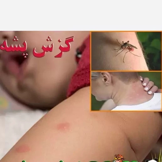 سم پشه کش بات بدون بو ارسال رایگان مدل 1
